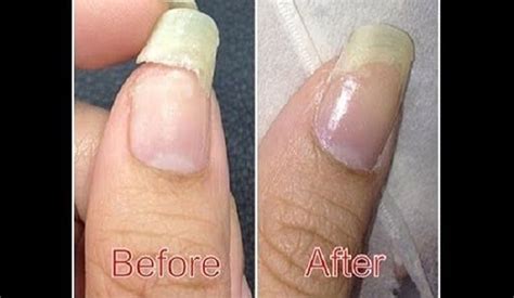 What glue does not damage nails?