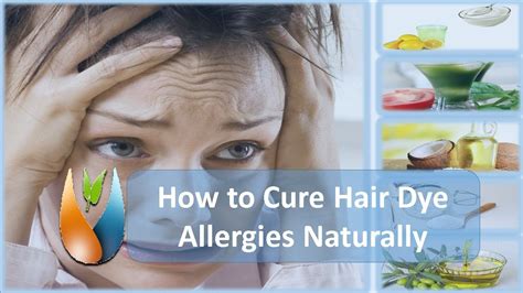 What hair dye can I use if I'm allergic?