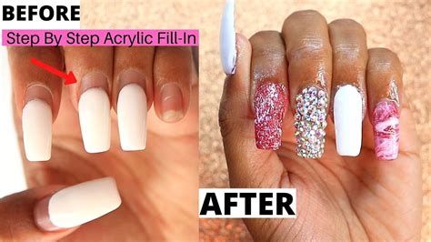 What happens during an acrylic fill?