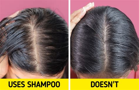 What happens if I dont use shampoo for a week?