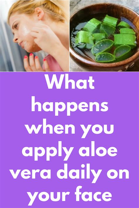 What happens if I put aloe vera on my acne?