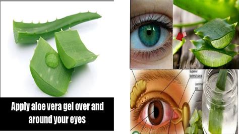 What happens if aloe vera goes into eyes?