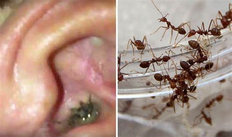 What happens if an ant climbs into your ear?