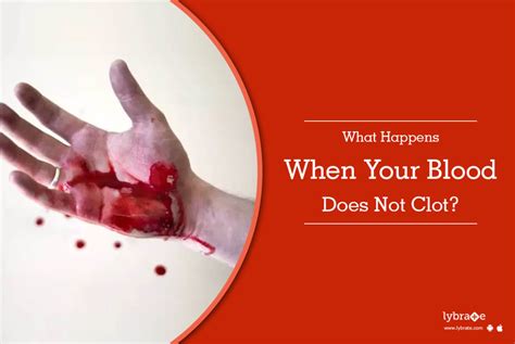 What happens if blood does not cloth?