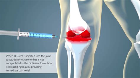 What happens if injection goes into bone?