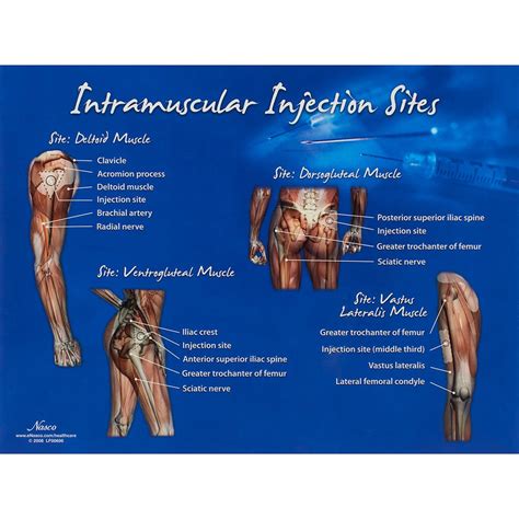 What happens if injection goes into muscle?