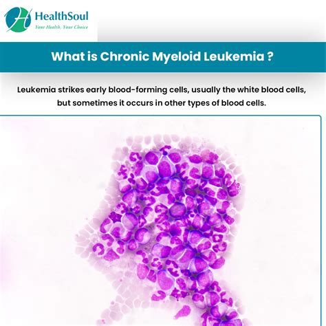 What happens if leukemia is not treated?