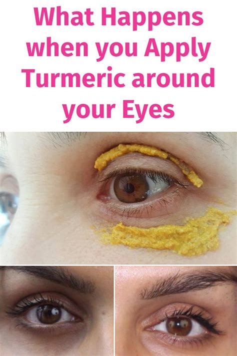 What happens if we apply only turmeric on face daily?