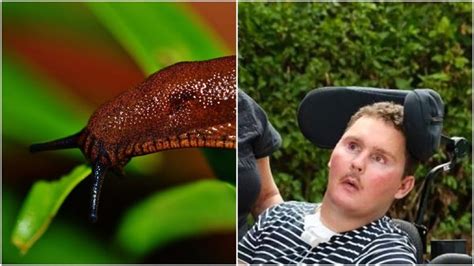 What happens if you accidentally swallow a slug?