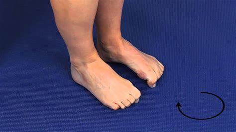 What happens if you bend your toe too far back?
