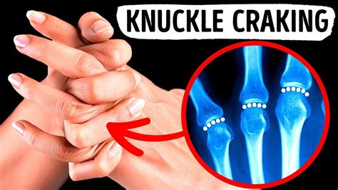 What happens if you crush your knuckle?