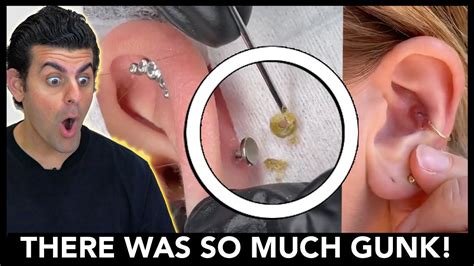 What happens if you don't clean your earrings?