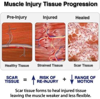 What happens if you don't massage a scar?