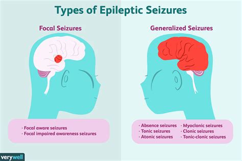 What happens if you don't treat focal seizures?