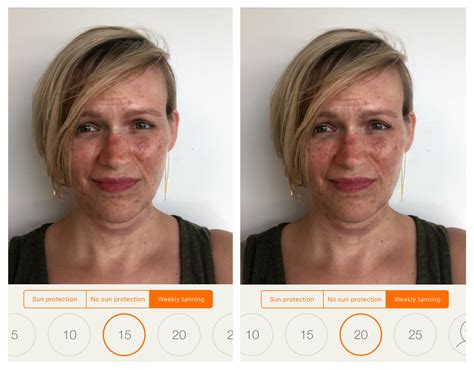 What happens if you don't use sunscreen after AHA?