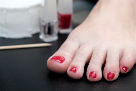 What happens if you don t remove nail polish before surgery?