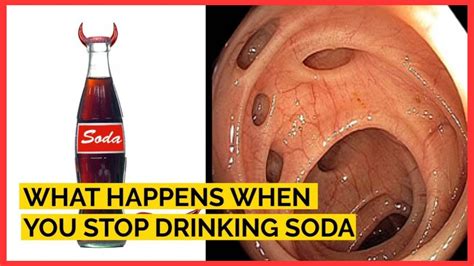 What happens if you flick a soda can?
