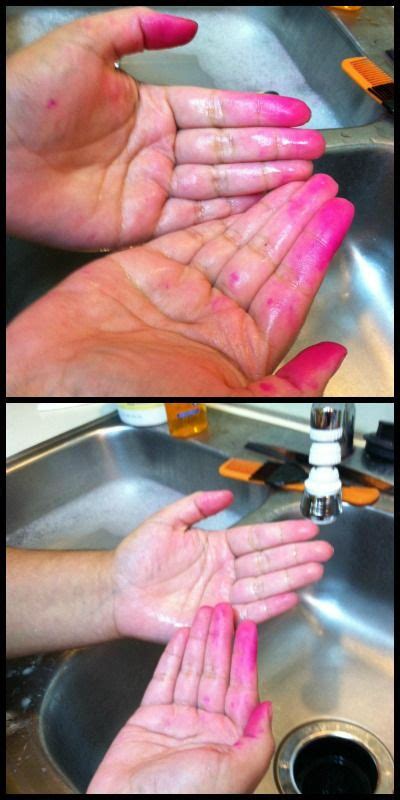 What happens if you get dye on your hand?