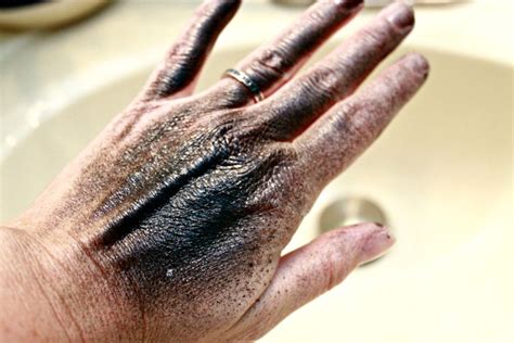 What happens if you get paint remover on your hands?