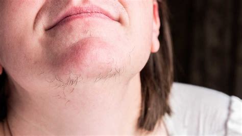 What happens if you have hair under your chin?