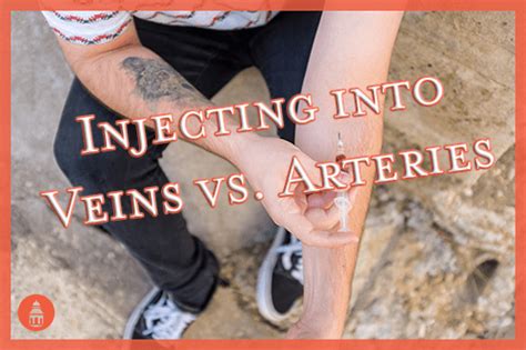 What happens if you hit an artery instead of a vein?