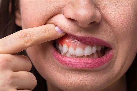What happens if you ignore a gum infection?