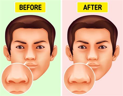 What happens if you never pick your nose?