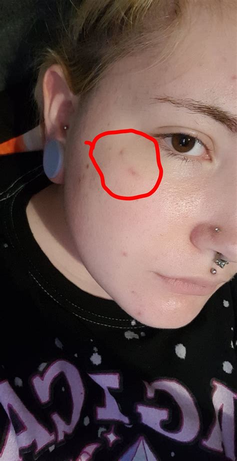 What happens if you never take a piercing out?