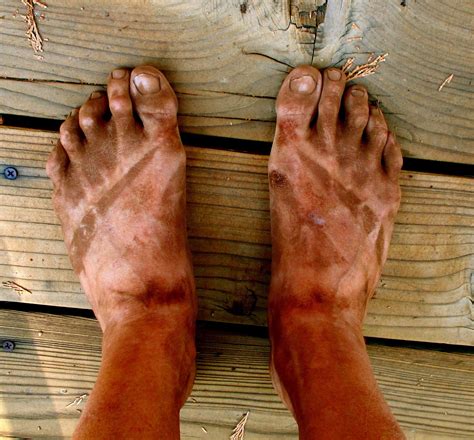 What happens if you never wash your feet?