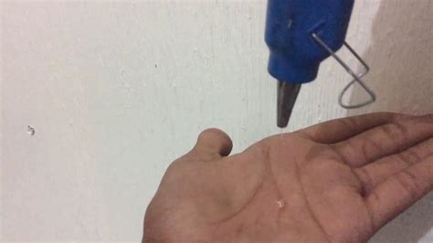 What happens if you put hot glue on your hand?