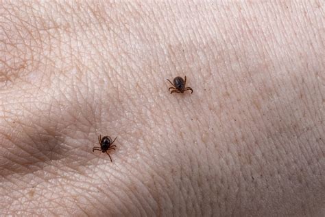 What happens if you touch a tick with bare hands?