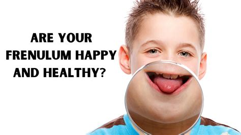 What happens if your frenulum is too long?