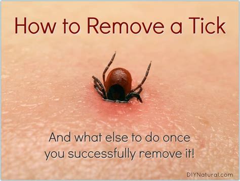 What happens to a tick if it is not removed?
