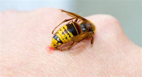 What happens to an untreated wasp sting?