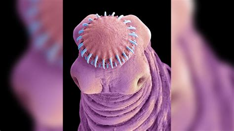 What happens to dead tapeworms?