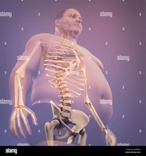 What happens to the skeleton of an obese person?