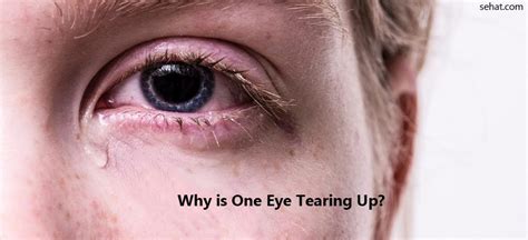 What happens to your eyes when you cry too much?