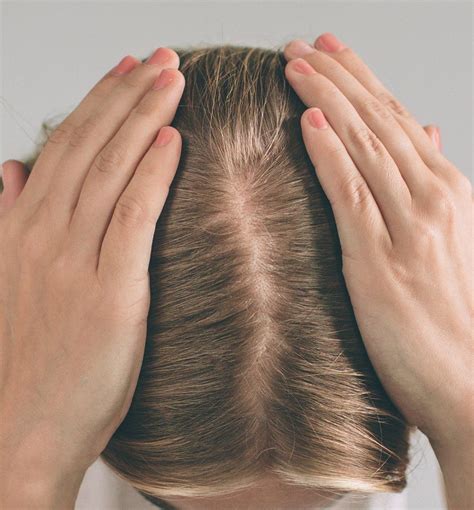 What happens when you don't exfoliate your scalp?