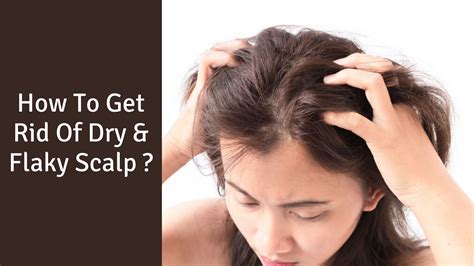 What happens when you scratch dry scalp?