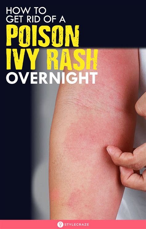 What heals a rash overnight?