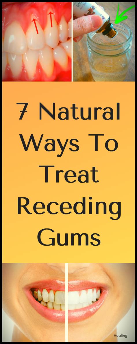 What heals gum fast?