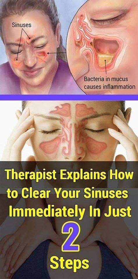 What heals sinusitis?