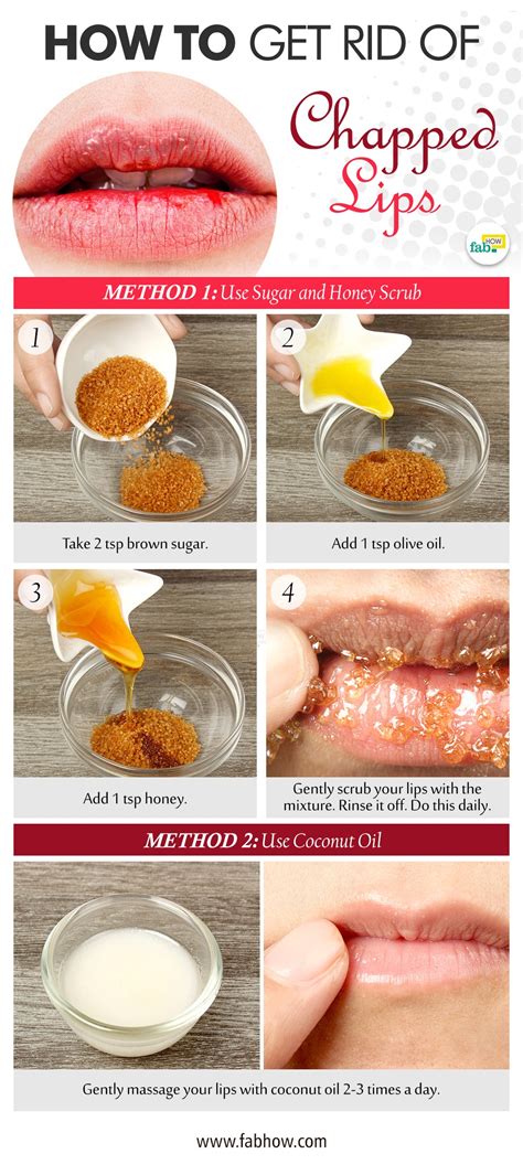 What helps chapped lips in 5 minutes?