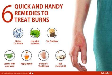 What helps heal burns quickly?