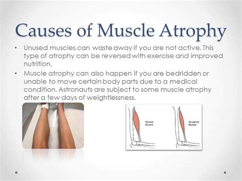 What hormone causes muscle atrophy?