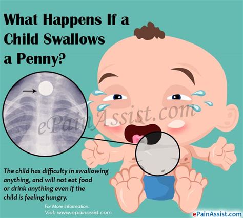 What if my 2 year old swallowed a penny?