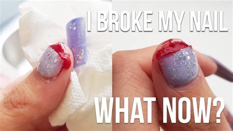 What if my acrylic nail breaks and is bleeding?