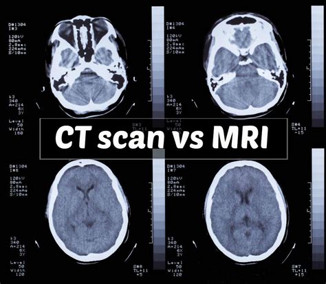 What if nothing shows up on MRI?