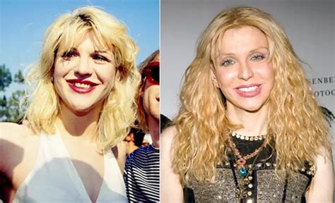 What illness has Courtney Love got?