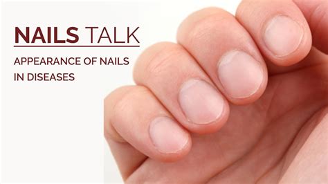What illnesses can be detected by your fingernails?